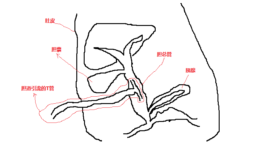 170649x4rmemxbjmgcjpgk.png