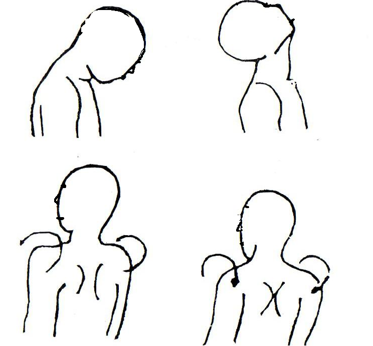 171110vuldumkhh17h0hhh.png