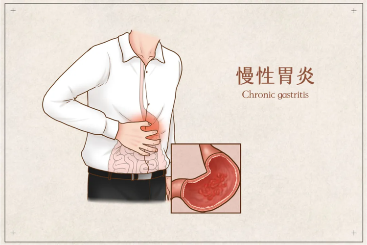 171712koa5448u3rh55ta9.png