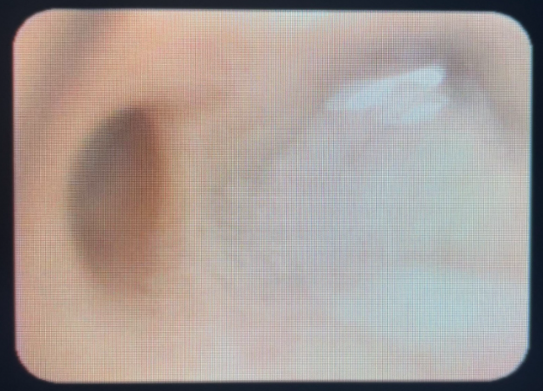 165454f9wx73vhw7bmwbrj.png